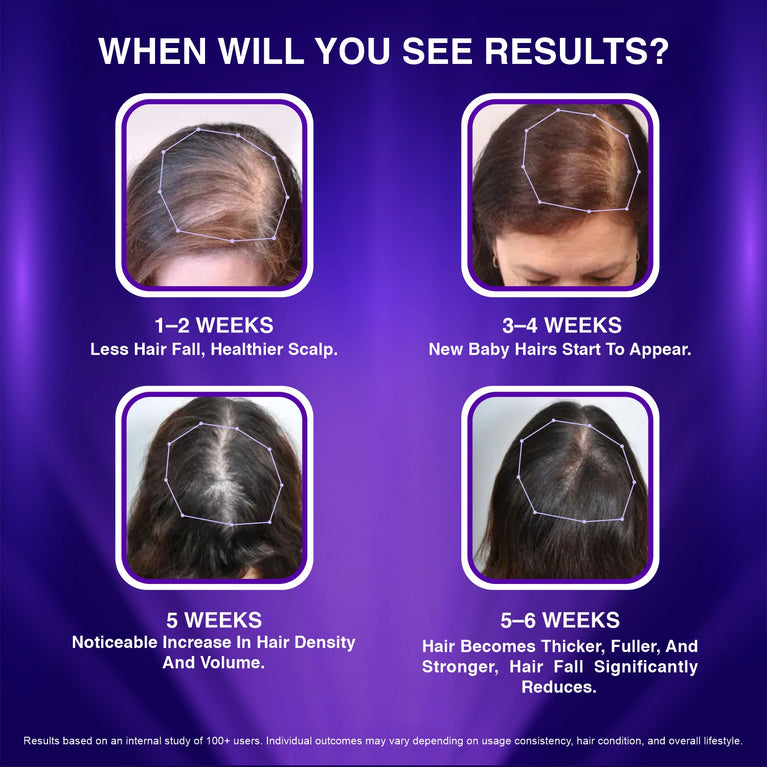 Visible Hair Regrowth, Reduced Hair Fall, Improved Hair Density and Thicker Hair in Men & Women Using Redensyl, Procapil, Anagain, Baicapil, Caffeine, Biotin & Niacinamide