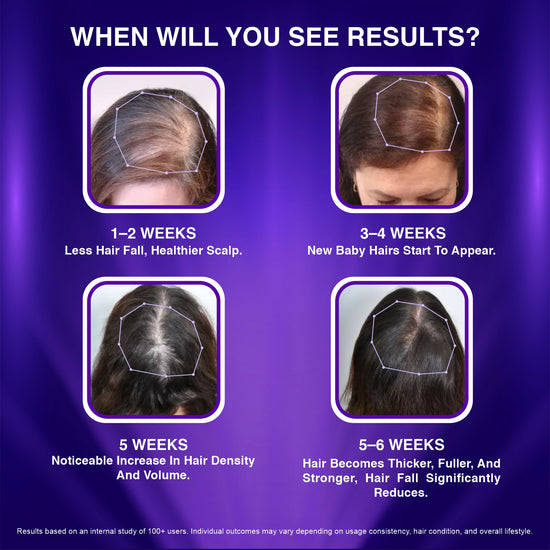 Visible Hair Regrowth, Reduced Hair Fall, Improved Hair Density and Thicker Hair in Men & Women Using Redensyl, Procapil, Anagain, Baicapil, Caffeine, Biotin & Niacinamide